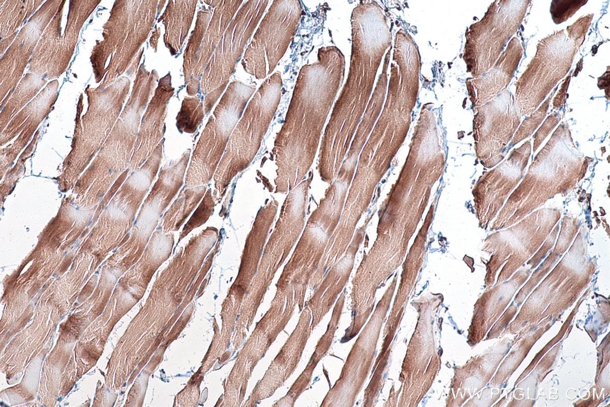 Immunohistochemical analysis of paraffin-embedded rat skeletal muscle tissue slide using KHC0553 (HADHA IHC Kit).