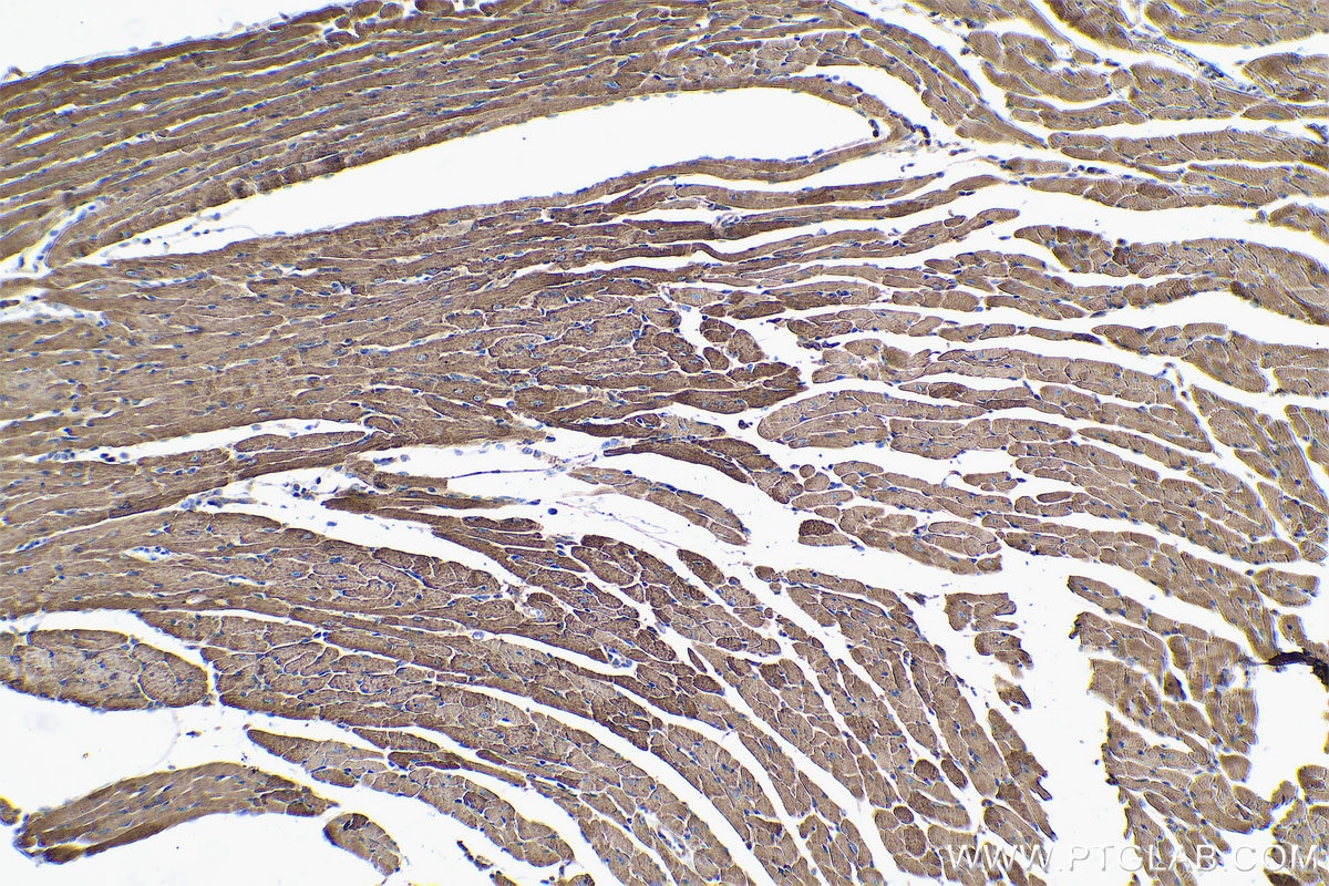 Immunohistochemical analysis of paraffin-embedded mouse heart tissue slide using KHC0554 (HADHB IHC Kit).