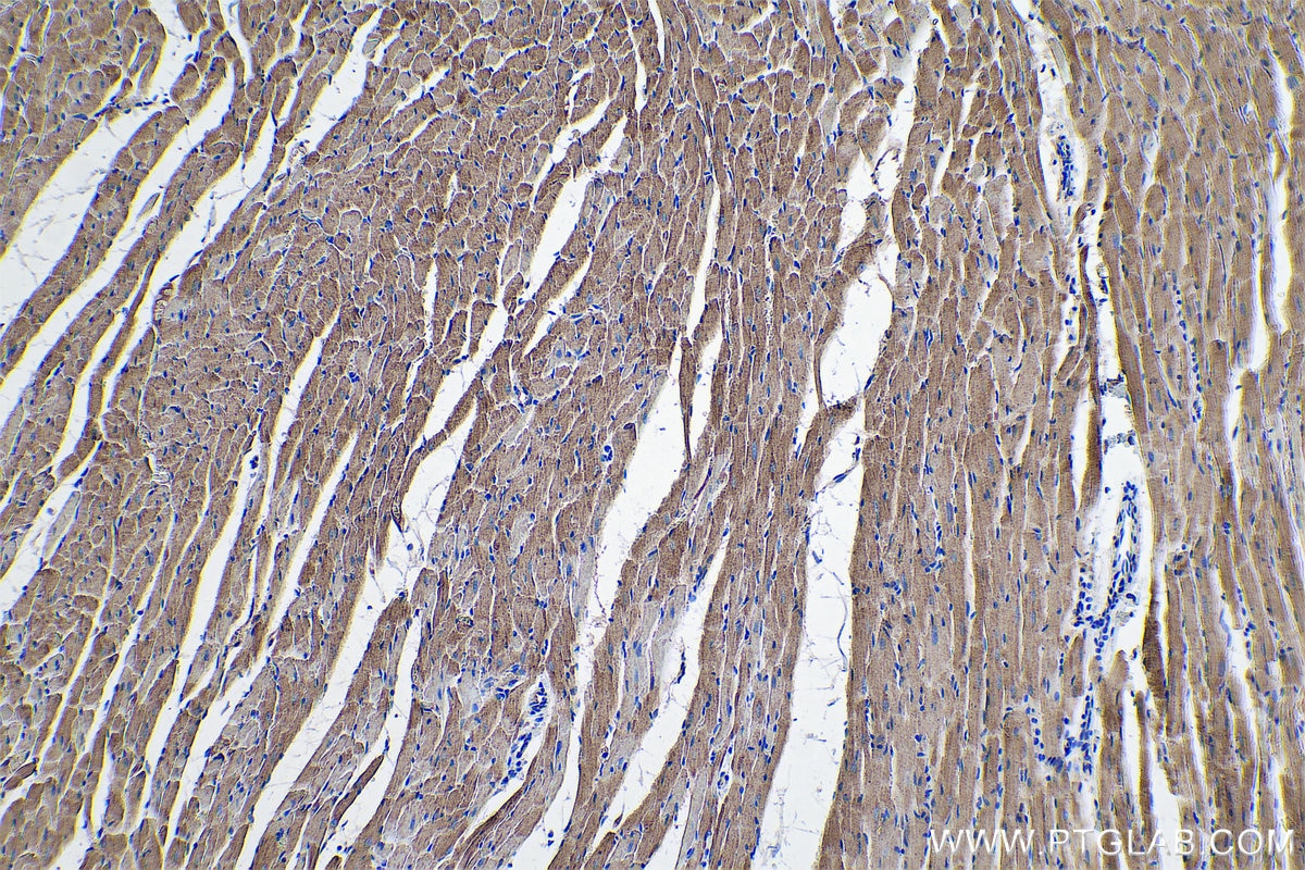 Immunohistochemical analysis of paraffin-embedded rat heart tissue slide using KHC0554 (HADHB IHC Kit).