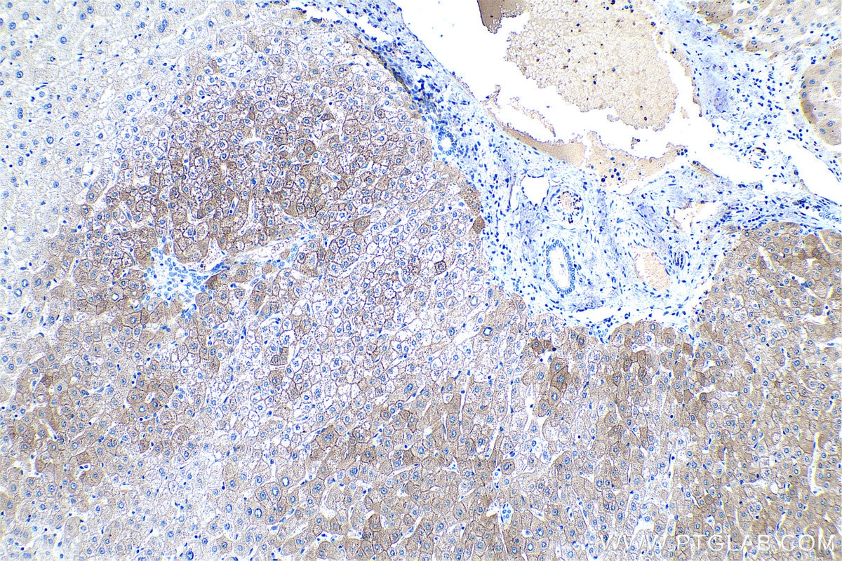 Immunohistochemical analysis of paraffin-embedded human liver tissue slide using KHC0487 (HAL IHC Kit).