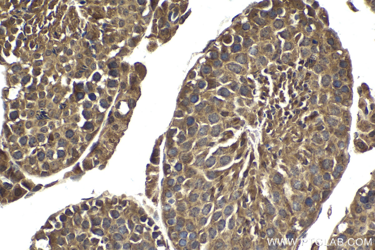 Immunohistochemical analysis of paraffin-embedded mouse testis tissue slide using KHC1627 (HAP1 IHC Kit).