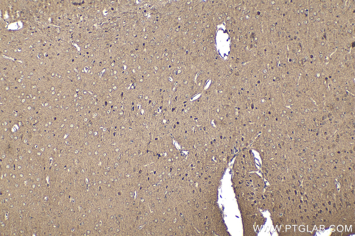 Immunohistochemical analysis of paraffin-embedded mouse brain tissue slide using KHC1627 (HAP1 IHC Kit).