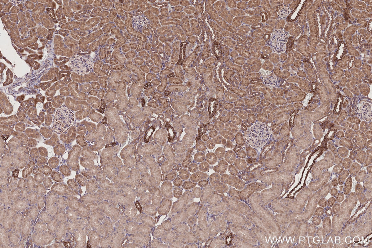 Immunohistochemical analysis of paraffin-embedded rat kidney tissue slide using KHC2782 (HAUS1 IHC Kit).