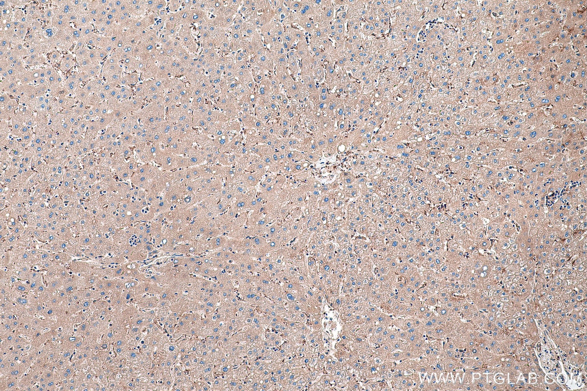 Immunohistochemical analysis of paraffin-embedded human liver tissue slide using KHC0556 (HBB IHC Kit).