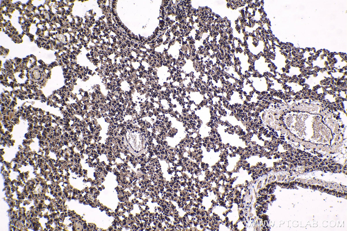 Immunohistochemical analysis of paraffin-embedded mouse lung tissue slide using KHC1619 (HCFC1 IHC Kit).