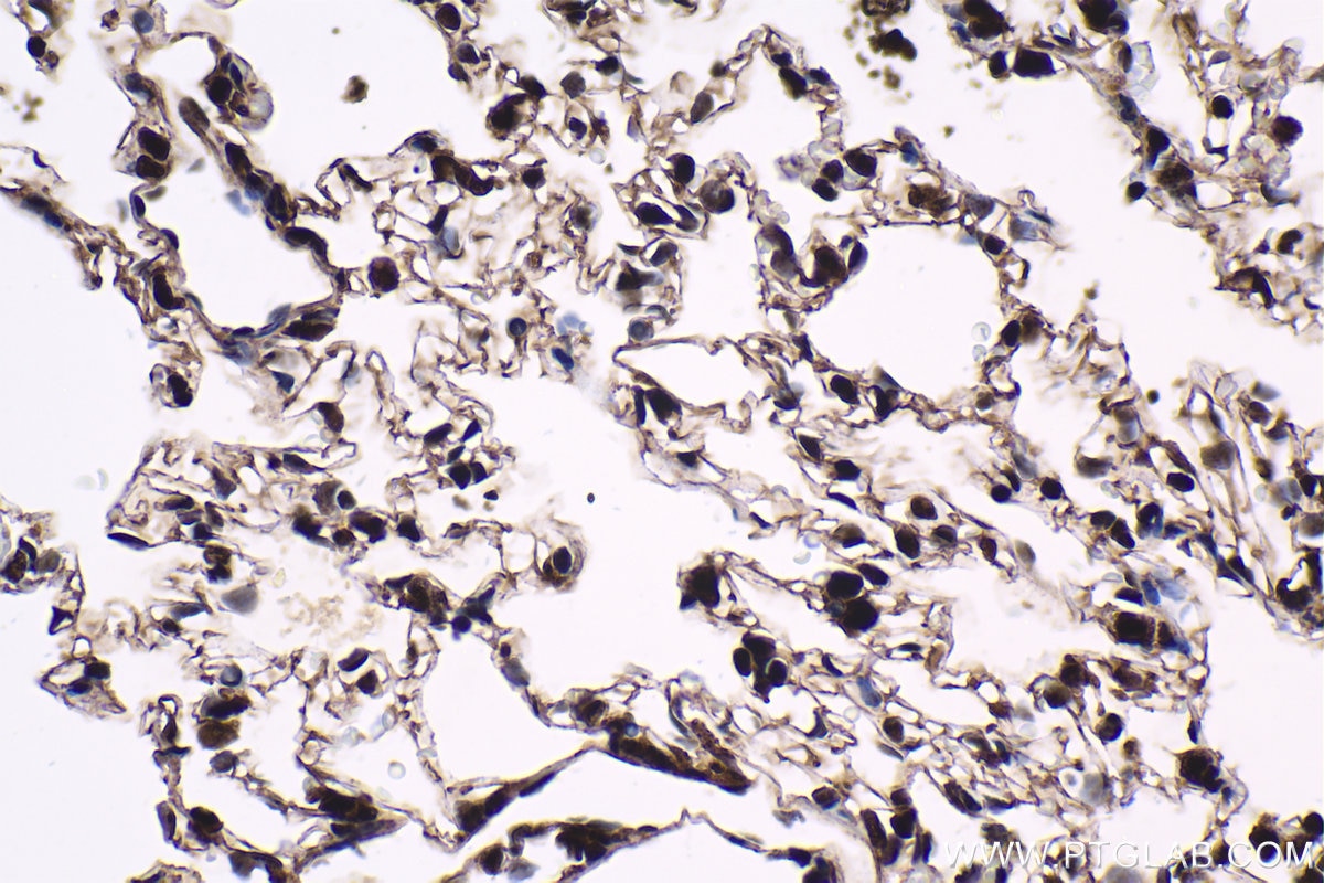 Immunohistochemical analysis of paraffin-embedded rat lung tissue slide using KHC1619 (HCFC1 IHC Kit).