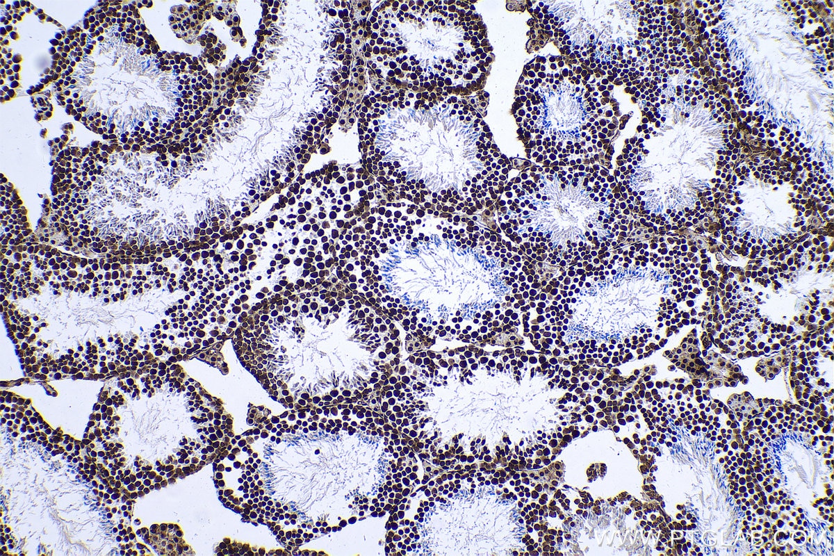 Immunohistochemical analysis of paraffin-embedded mouse testis tissue slide using KHC0613 (HDAC1 IHC Kit).