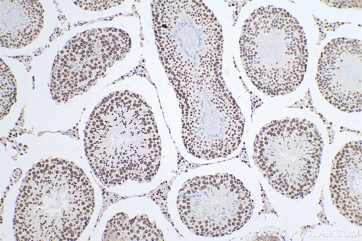 Immunohistochemical analysis of paraffin-embedded rat testis tissue slide using KHC0613 (HDAC1 IHC Kit).
