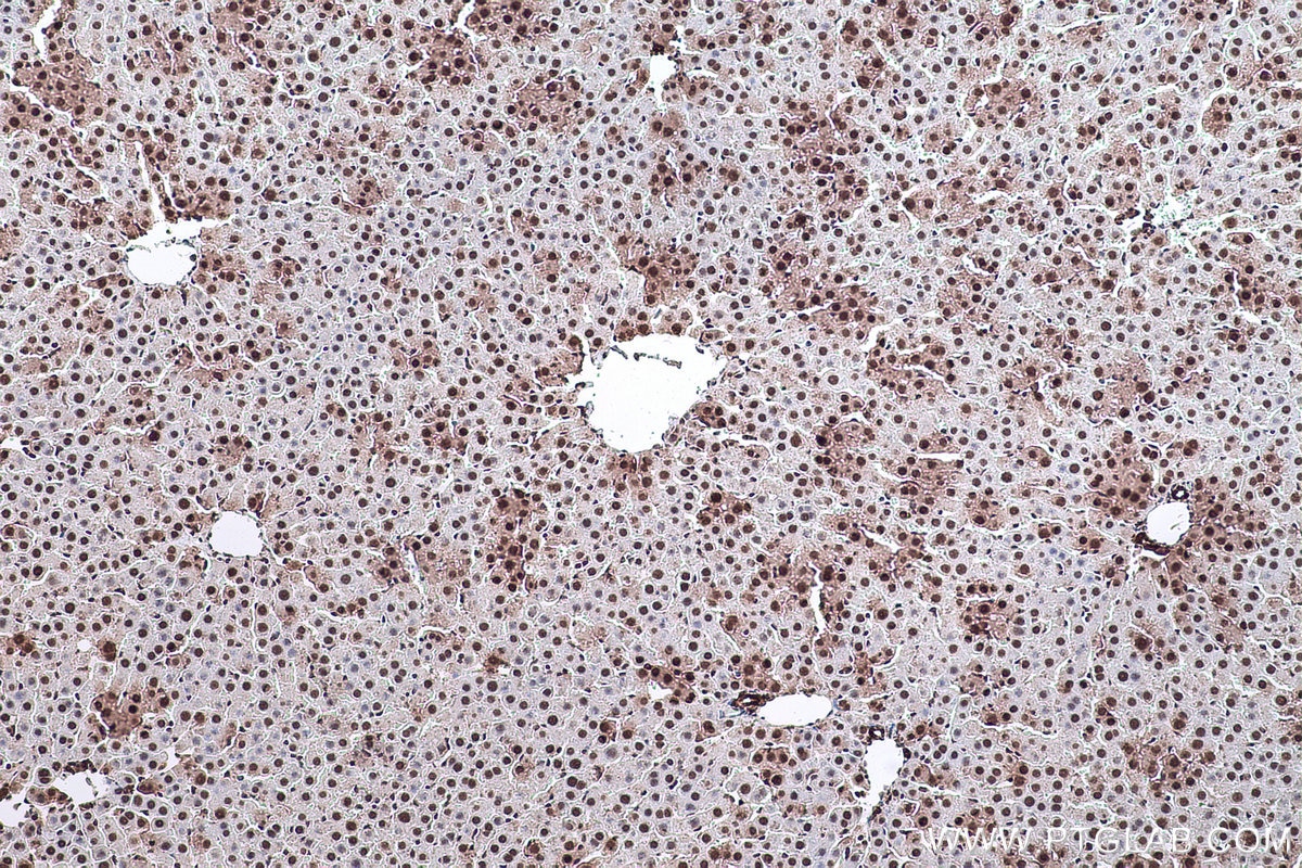 Immunohistochemical analysis of paraffin-embedded rat liver tissue slide using KHC0618 (HDAC10 IHC Kit).