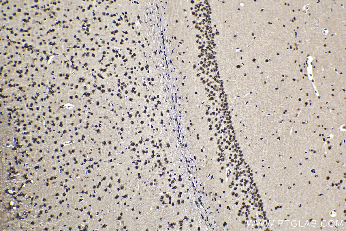 Immunohistochemical analysis of paraffin-embedded mouse brain tissue slide using KHC1853 (HDAC2 IHC Kit).