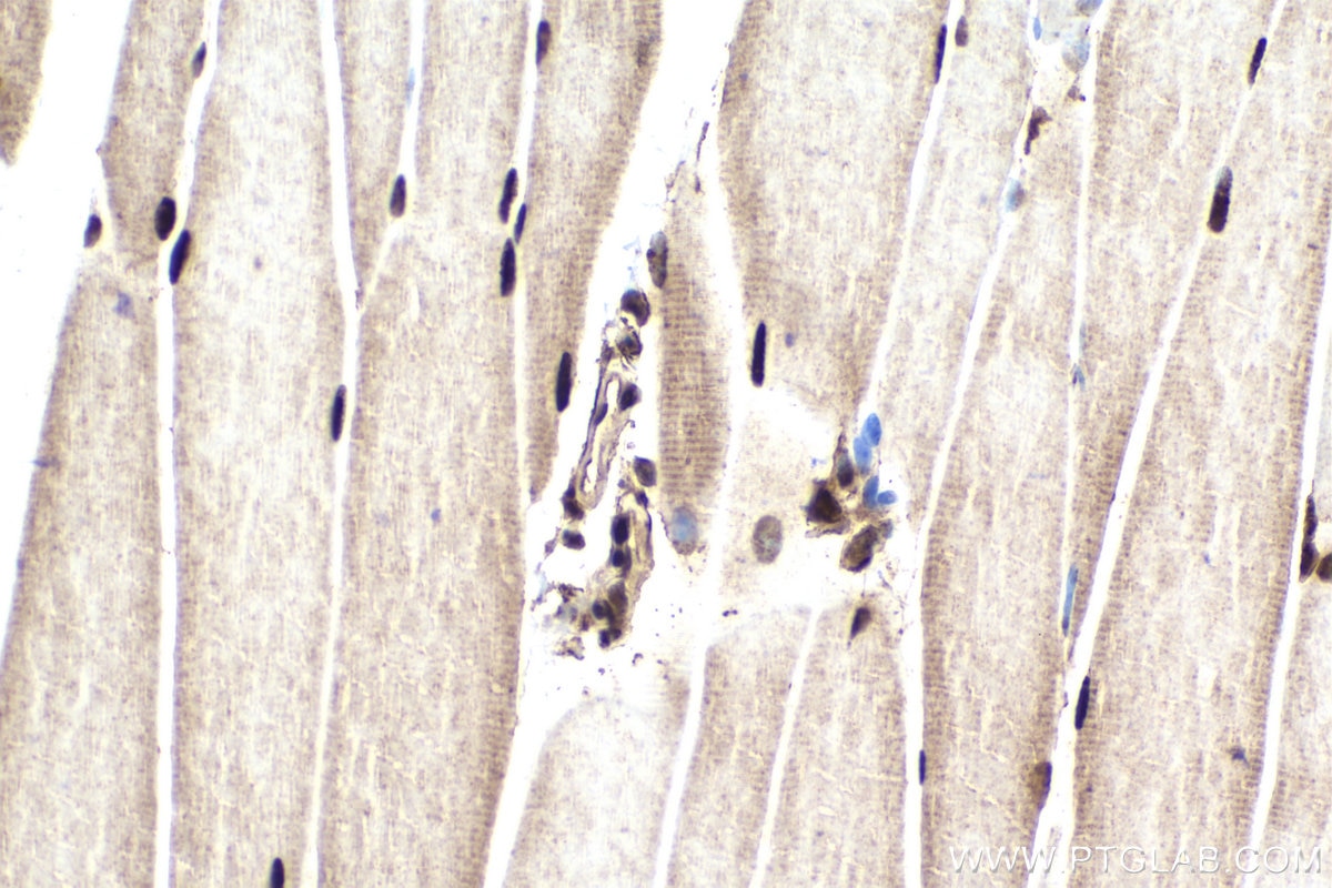 Immunohistochemical analysis of paraffin-embedded mouse skeletal muscle tissue slide using KHC1853 (HDAC2 IHC Kit).