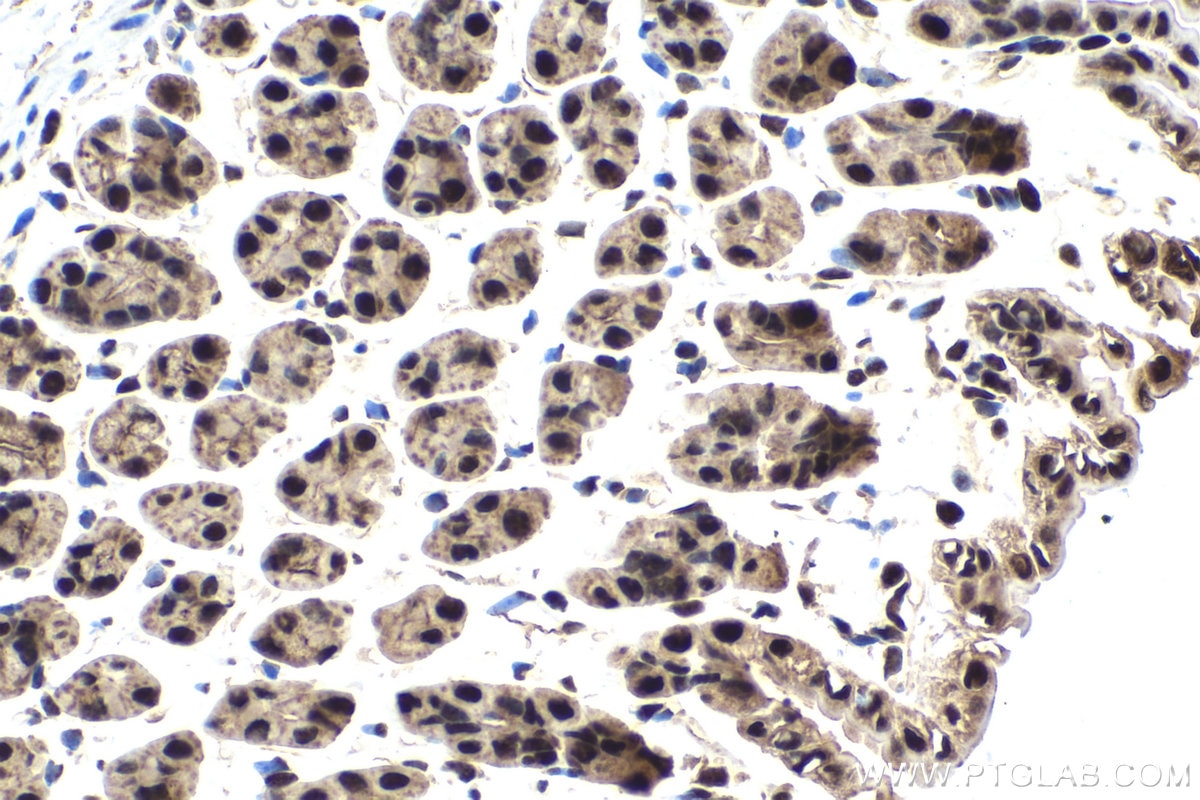 Immunohistochemical analysis of paraffin-embedded mouse stomach tissue slide using KHC1853 (HDAC2 IHC Kit).