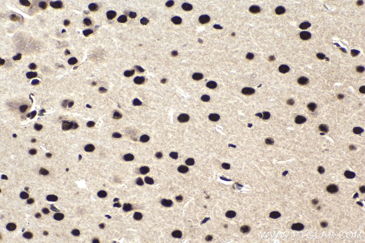 Immunohistochemical analysis of paraffin-embedded rat brain tissue slide using KHC1853 (HDAC2 IHC Kit).