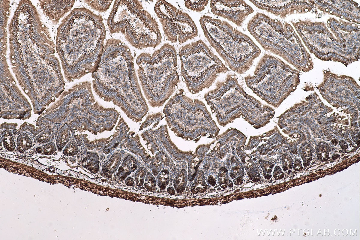 Immunohistochemical analysis of paraffin-embedded mouse small intestine tissue slide using KHC0615 (HDAC5 IHC Kit).