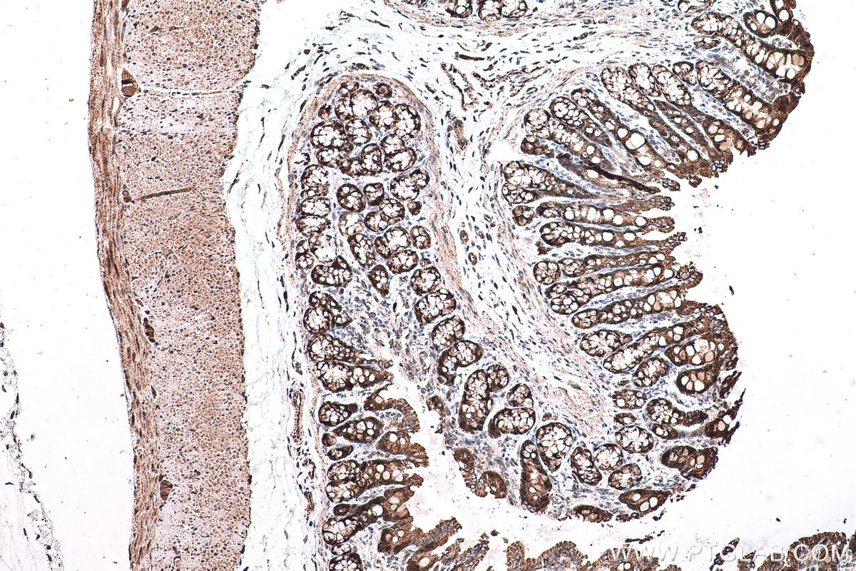 Immunohistochemical analysis of paraffin-embedded rat colon tissue slide using KHC0615 (HDAC5 IHC Kit).