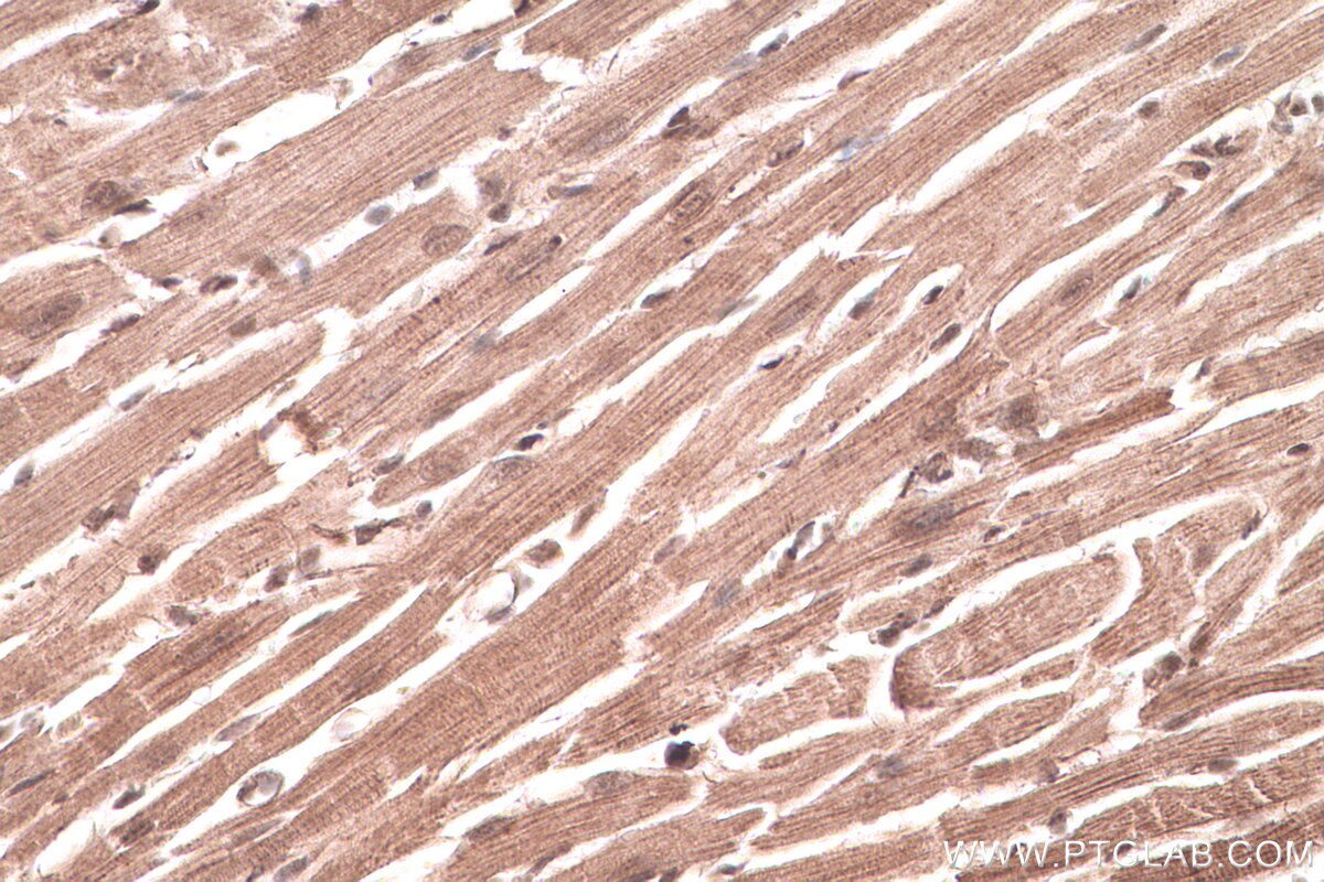 Immunohistochemical analysis of paraffin-embedded mouse heart tissue slide using KHC0617 (HDAC8 IHC Kit).