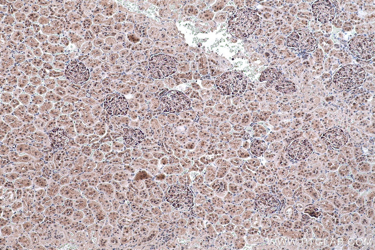 Immunohistochemical analysis of paraffin-embedded rat kidney tissue slide using KHC0617 (HDAC8 IHC Kit).