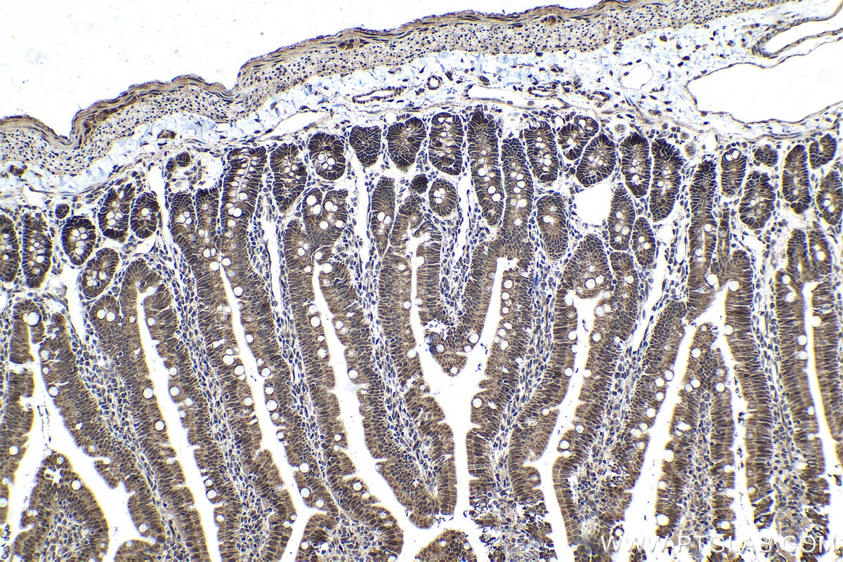 Immunohistochemical analysis of paraffin-embedded rat small intestine tissue slide using KHC1402 (HDGFL2 IHC Kit).