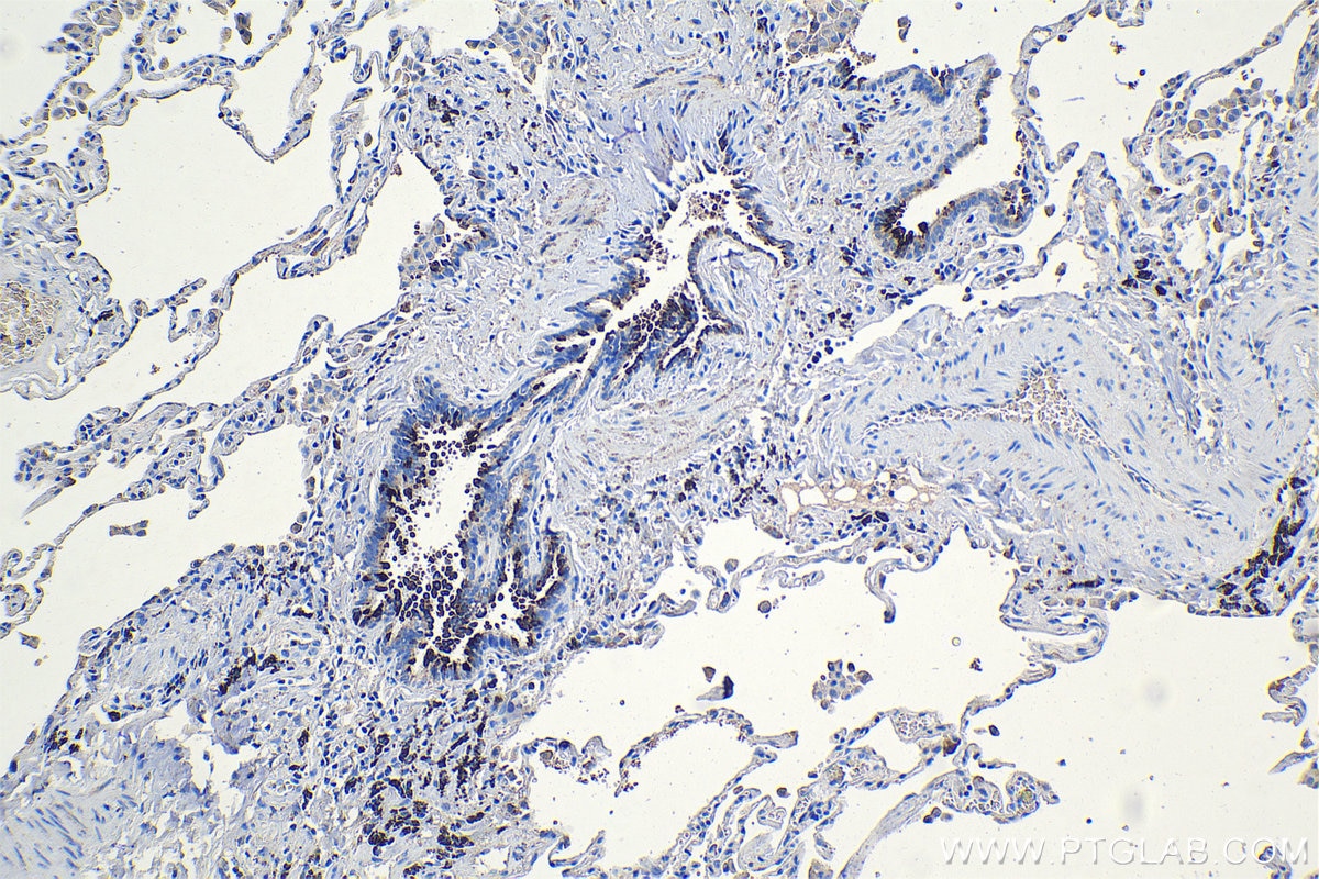 Immunohistochemical analysis of paraffin-embedded human lung tissue slide using KHC1165 (HE4 IHC Kit).