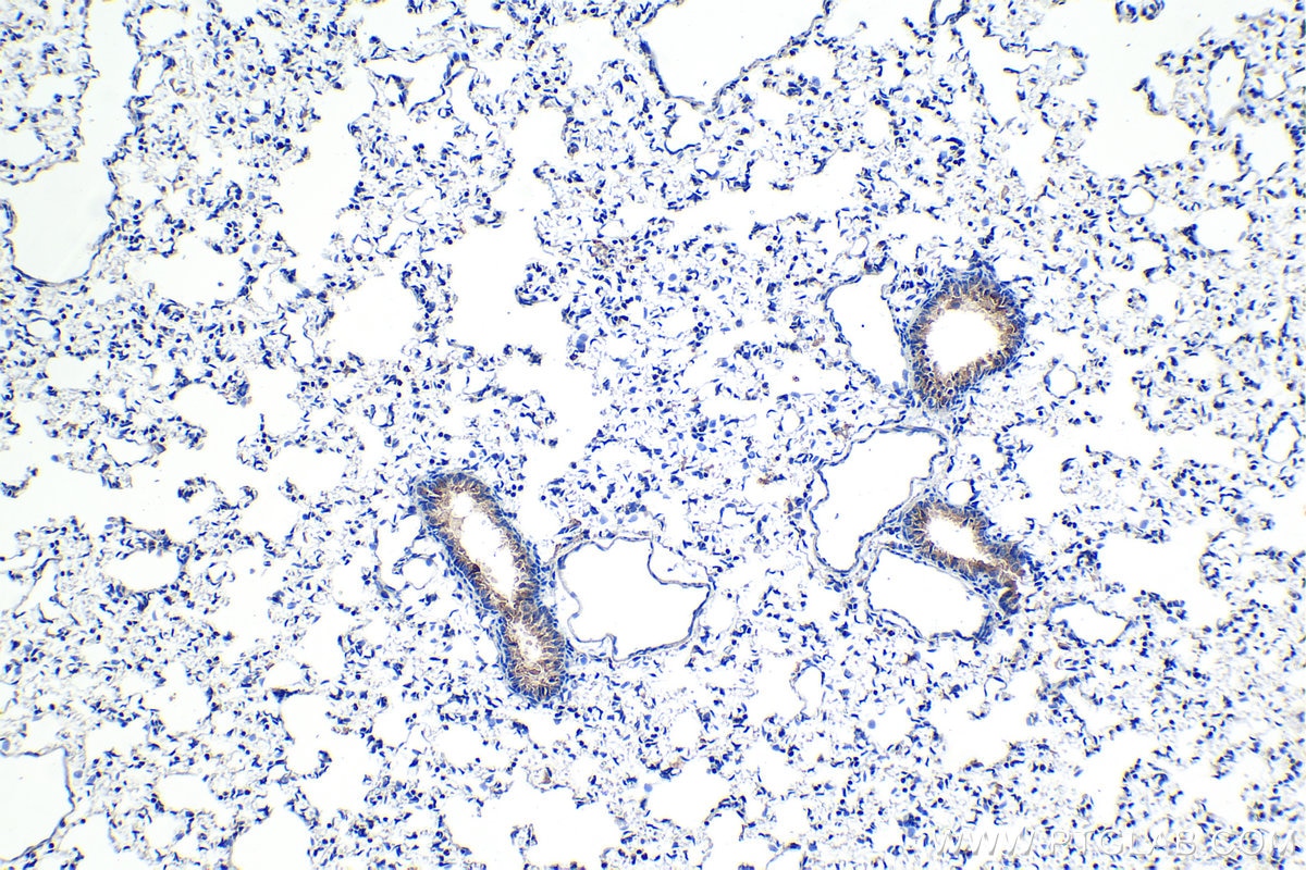 Immunohistochemical analysis of paraffin-embedded rat lung tissue slide using KHC1165 (HE4 IHC Kit).