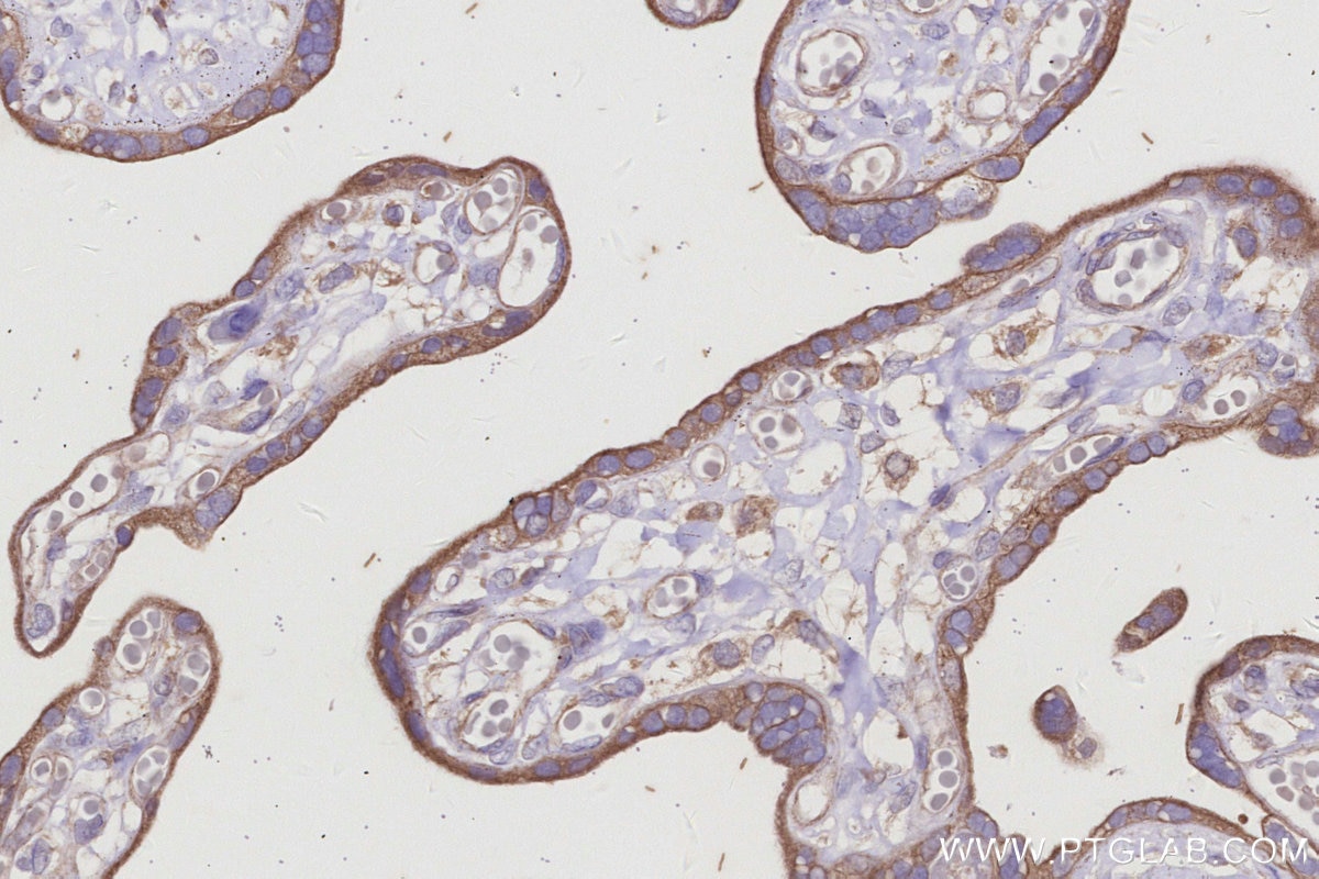Immunohistochemical analysis of paraffin-embedded human placenta tissue slide using KHC2992 (HEATR5B IHC Kit).