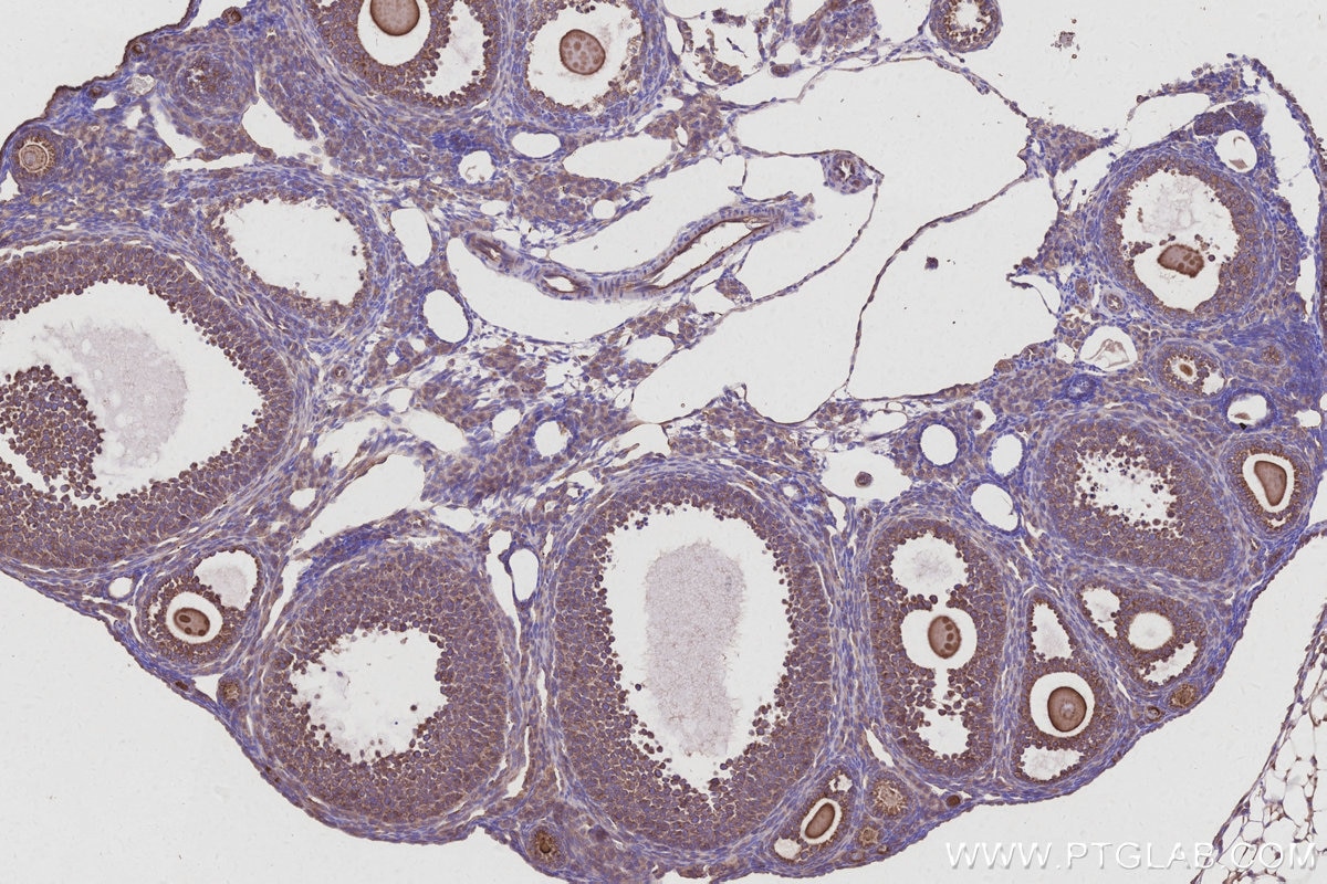 Immunohistochemical analysis of paraffin-embedded mouse ovary tissue slide using KHC2992 (HEATR5B IHC Kit).