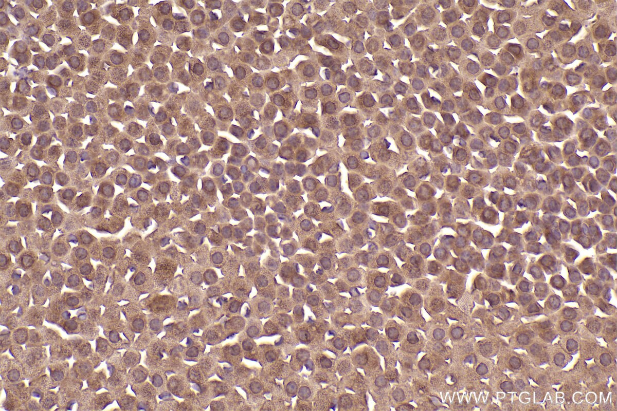 Immunohistochemical analysis of paraffin-embedded mouse adrenal gland tissue slide using KHC2553 (HECTD3 IHC Kit).
