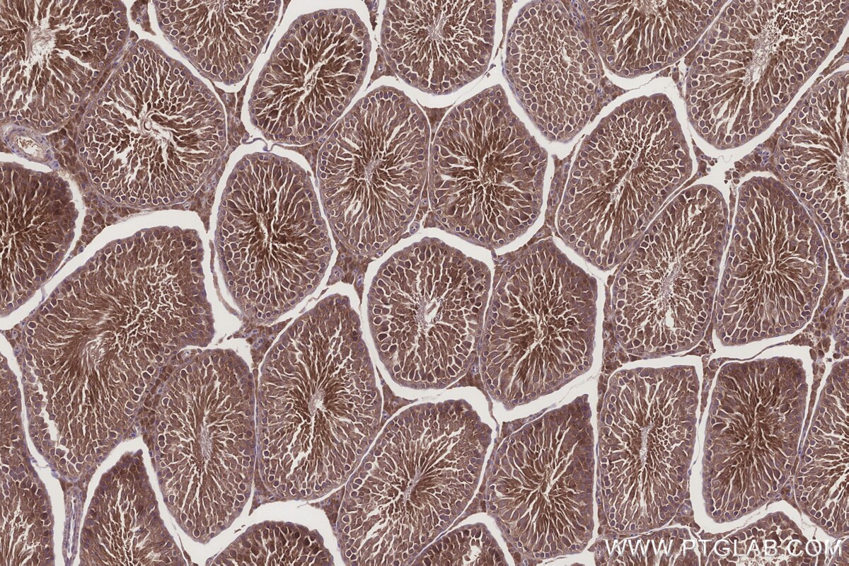 Immunohistochemical analysis of paraffin-embedded rat testis tissue slide using KHC3261 (HERC4 IHC Kit).