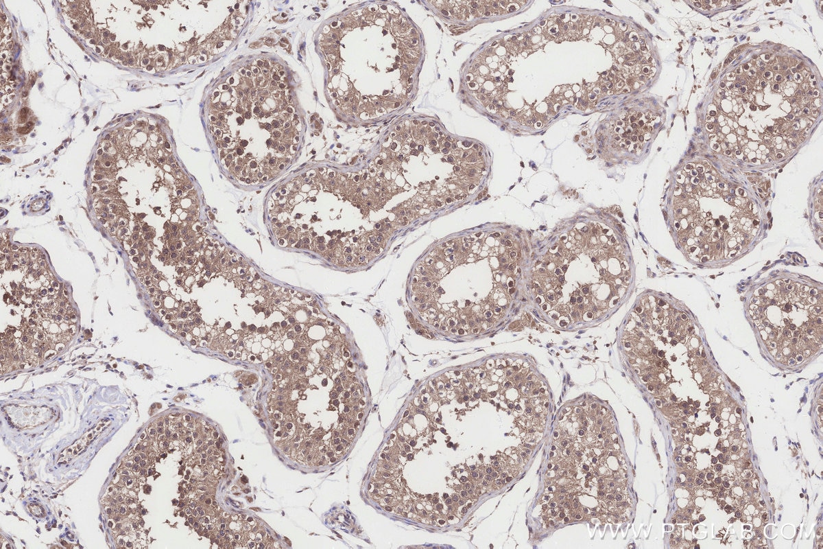 Immunohistochemical analysis of paraffin-embedded human testis tissue slide using KHC3261 (HERC4 IHC Kit).