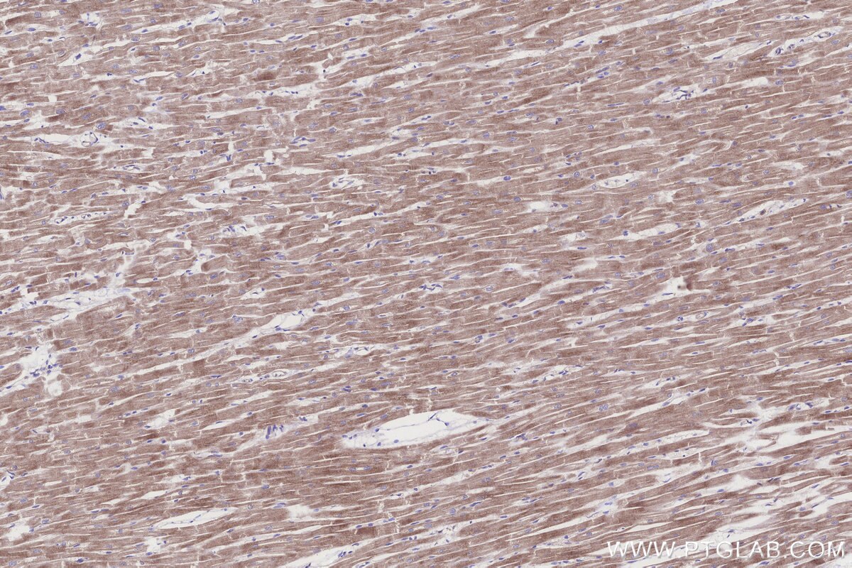 Immunohistochemical analysis of paraffin-embedded human heart tissue slide using KHC3261 (HERC4 IHC Kit).