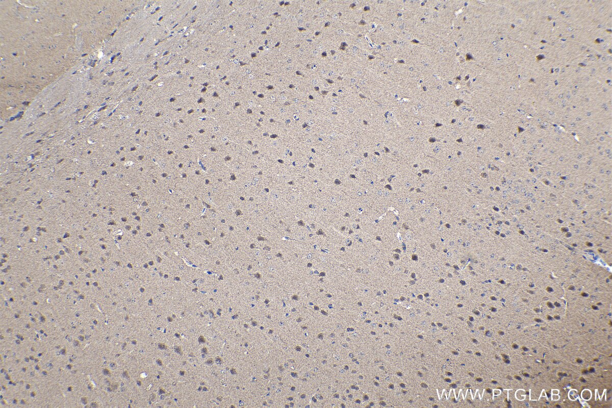 Immunohistochemical analysis of paraffin-embedded mouse brain tissue slide using KHC1133 (HEXB IHC Kit).