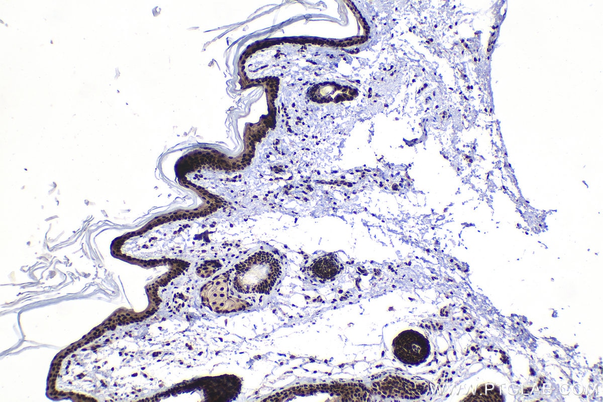 Immunohistochemical analysis of paraffin-embedded rat skin tissue slide using KHC1489 (HEXIM1 IHC Kit).