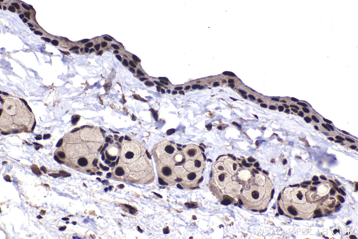 Immunohistochemical analysis of paraffin-embedded mouse skin tissue slide using KHC1489 (HEXIM1 IHC Kit).