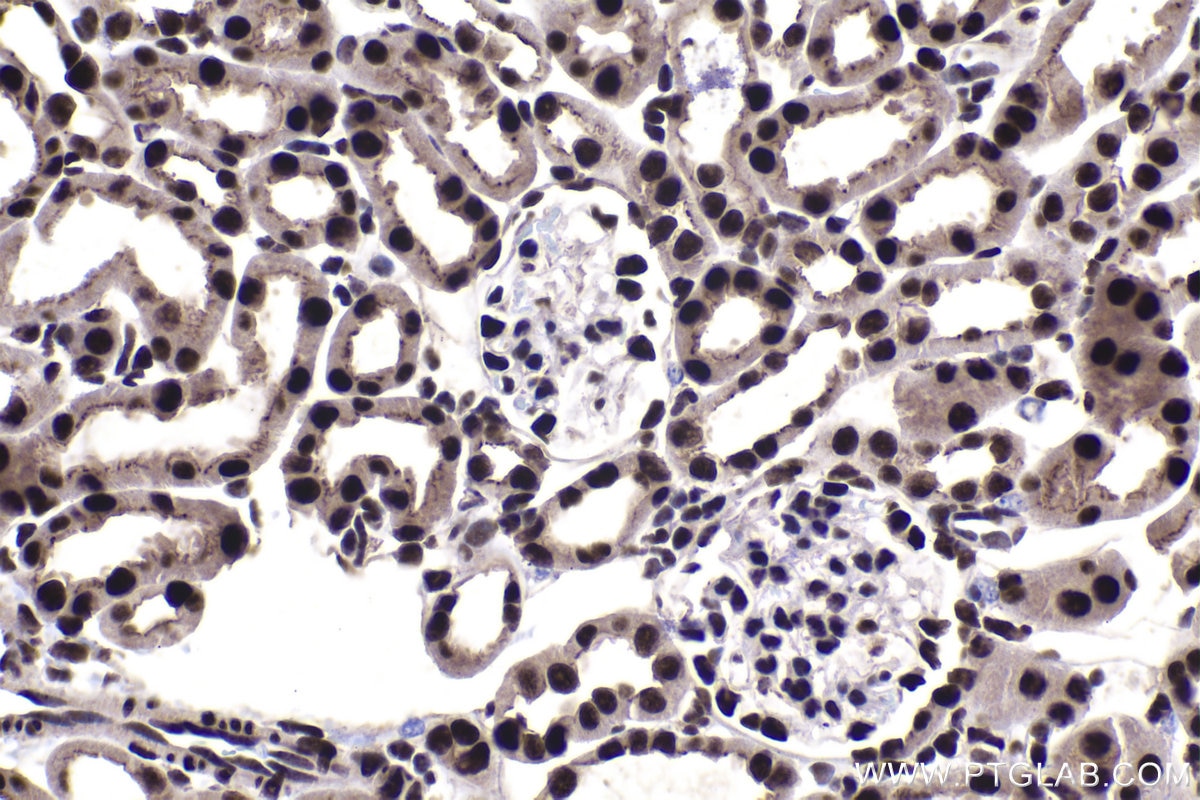 Immunohistochemical analysis of paraffin-embedded mouse kidney tissue slide using KHC1489 (HEXIM1 IHC Kit).
