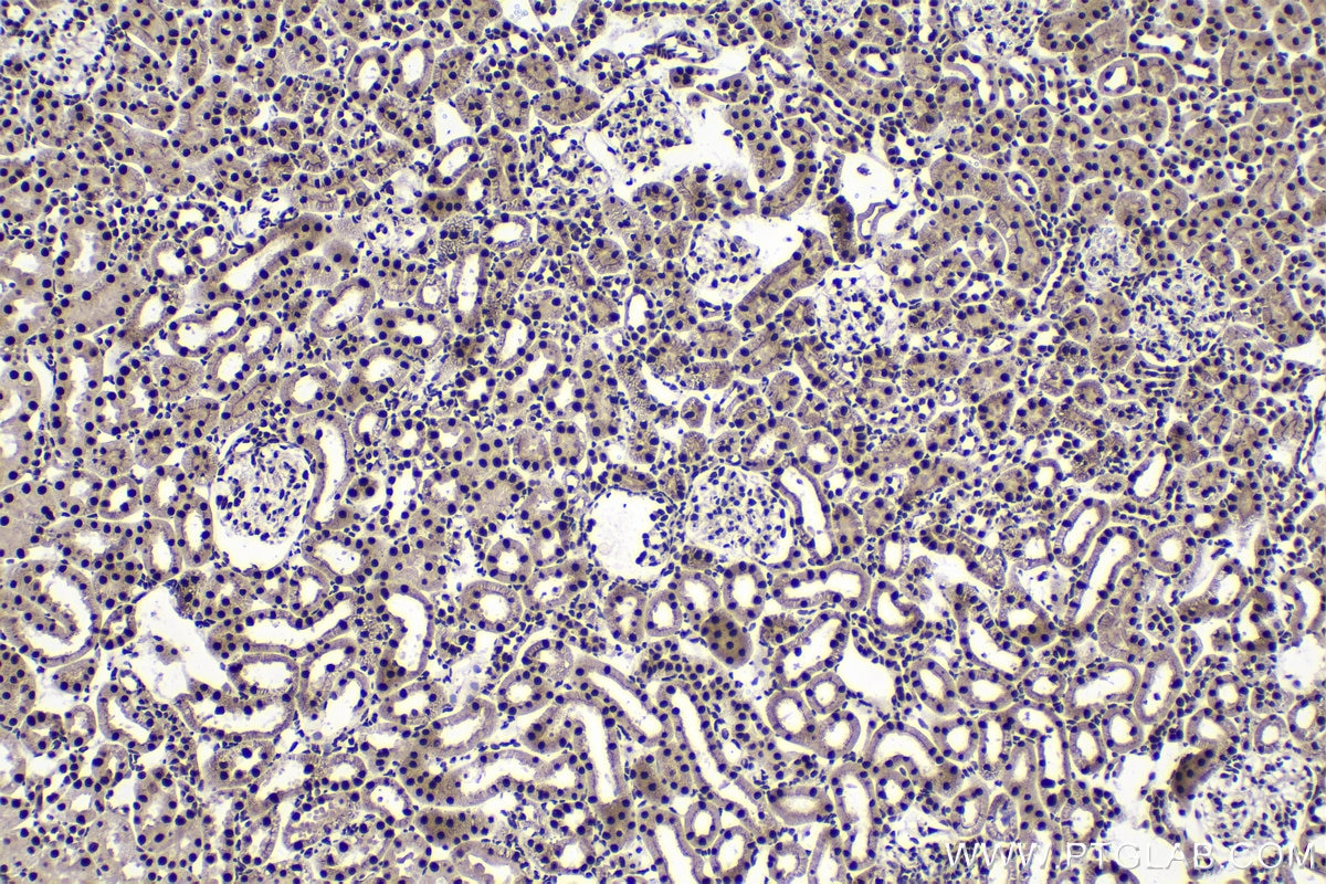 Immunohistochemical analysis of paraffin-embedded rat kidney tissue slide using KHC1489 (HEXIM1 IHC Kit).
