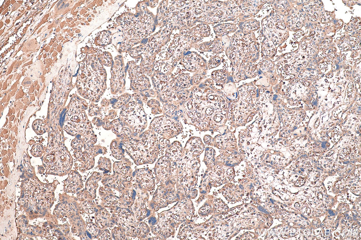 Immunohistochemical analysis of paraffin-embedded human placenta tissue slide using KHC0478 (HGF IHC Kit).