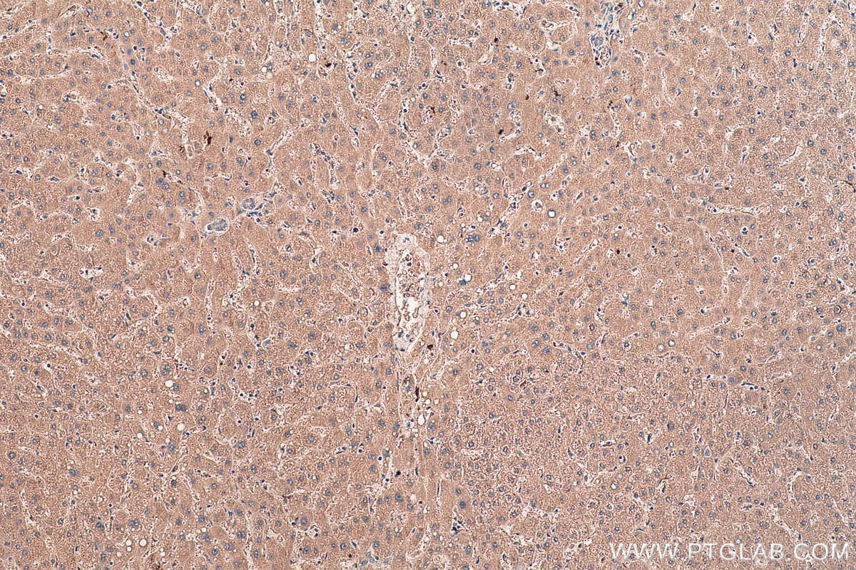 Immunohistochemical analysis of paraffin-embedded human liver tissue slide using KHC0478 (HGF IHC Kit).