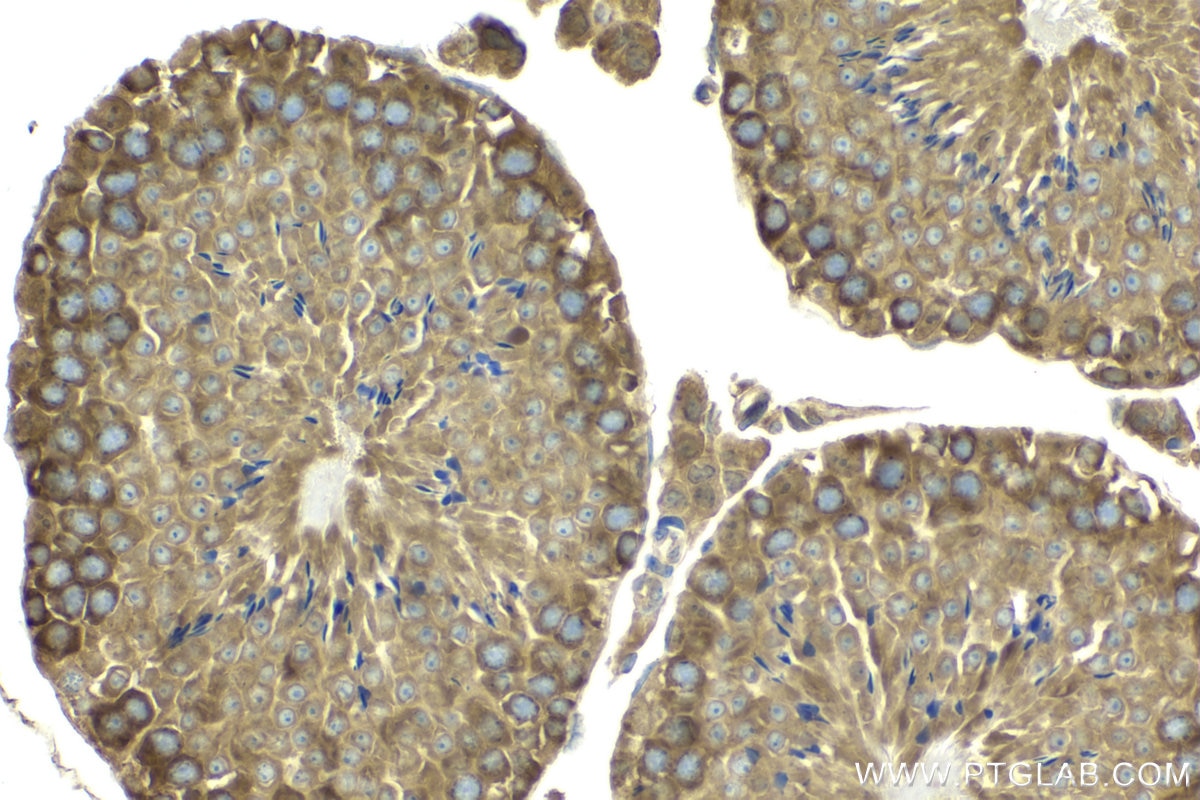 Immunohistochemical analysis of paraffin-embedded mouse testis tissue slide using KHC2063 (HGS IHC Kit).