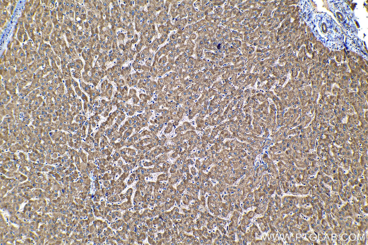 Immunohistochemical analysis of paraffin-embedded human liver tissue slide using KHC1310 (HIBCH IHC Kit).