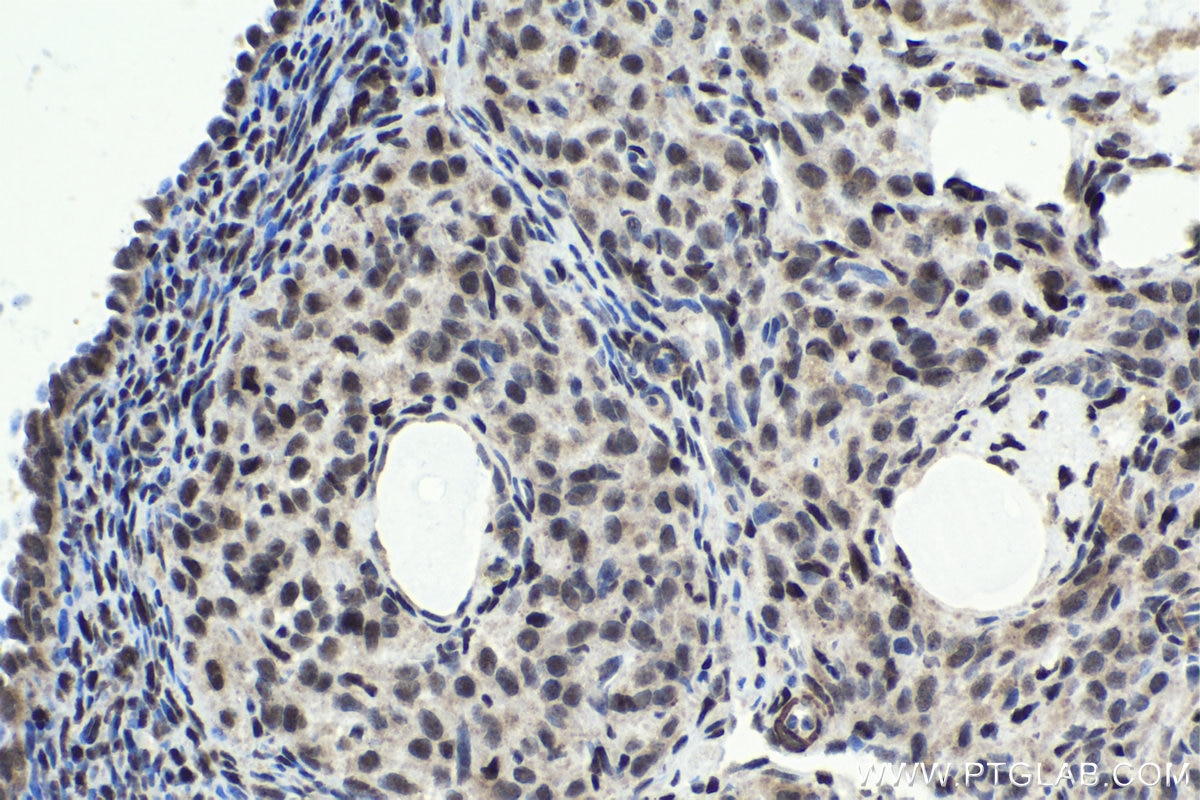 Immunohistochemical analysis of paraffin-embedded rat ovary tissue slide using KHC1732 (HIC1 IHC Kit).
