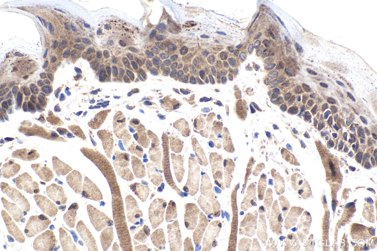 Immunohistochemical analysis of paraffin-embedded mouse tongue tissue slide using KHC1968 (HIF1AN IHC Kit).