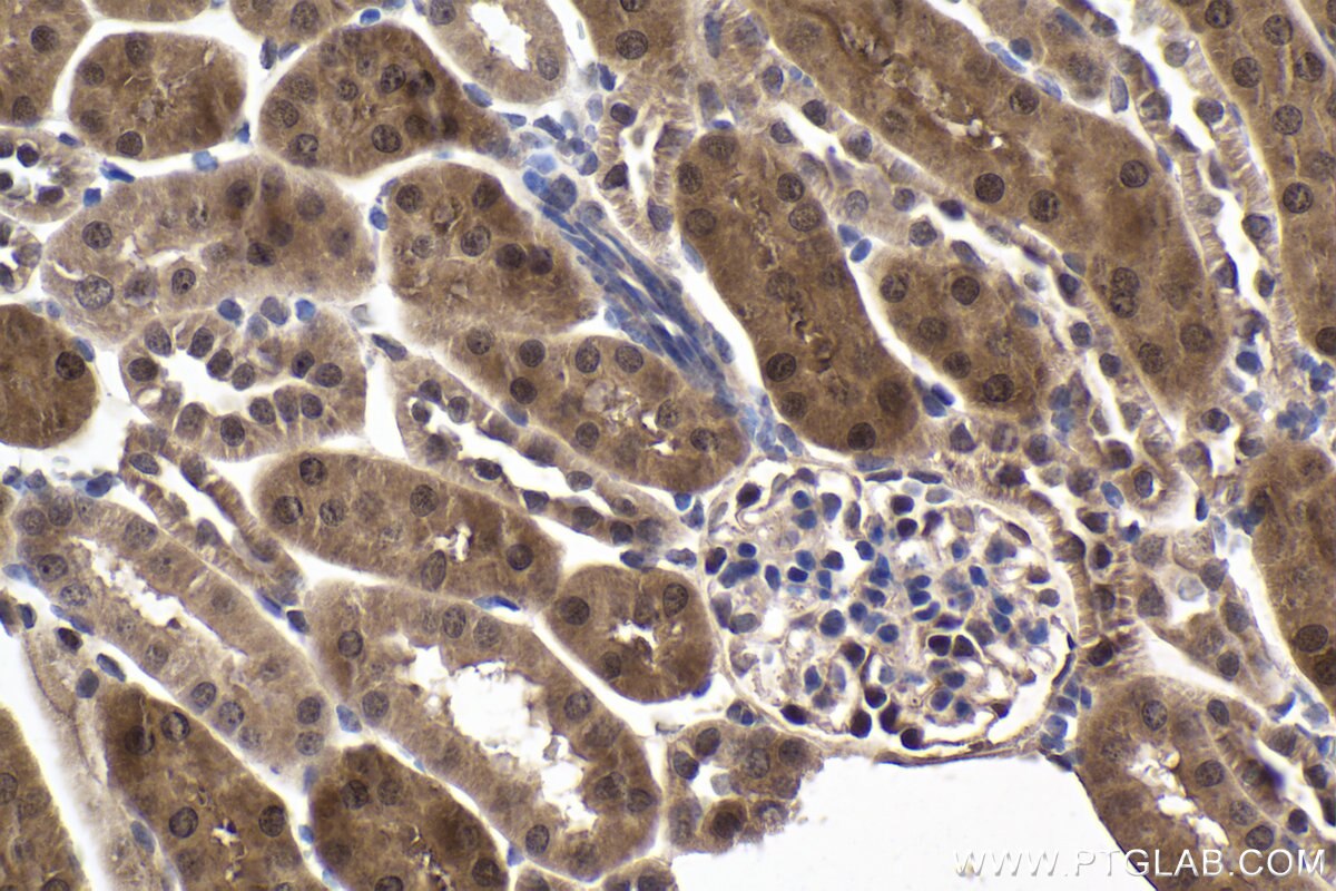 Immunohistochemical analysis of paraffin-embedded mouse kidney tissue slide using KHC2016 (HIF3A IHC Kit).