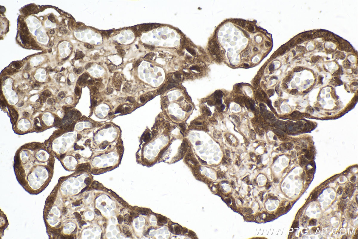 Immunohistochemical analysis of paraffin-embedded human placenta tissue slide using KHC2016 (HIF3A IHC Kit).