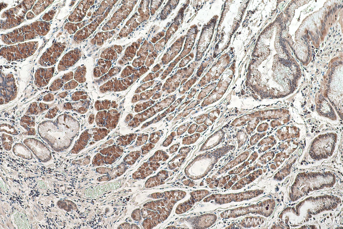 Immunohistochemical analysis of paraffin-embedded human stomach cancer(NAT) tissue slide using KHC0538 (HINT1 IHC Kit).