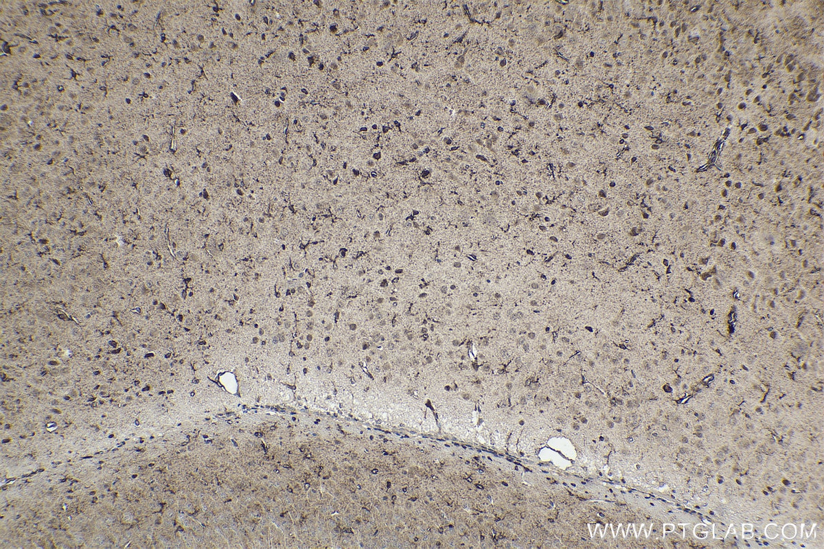 Immunohistochemical analysis of paraffin-embedded mouse brain tissue slide using KHC1929 (HIPK2 IHC Kit).