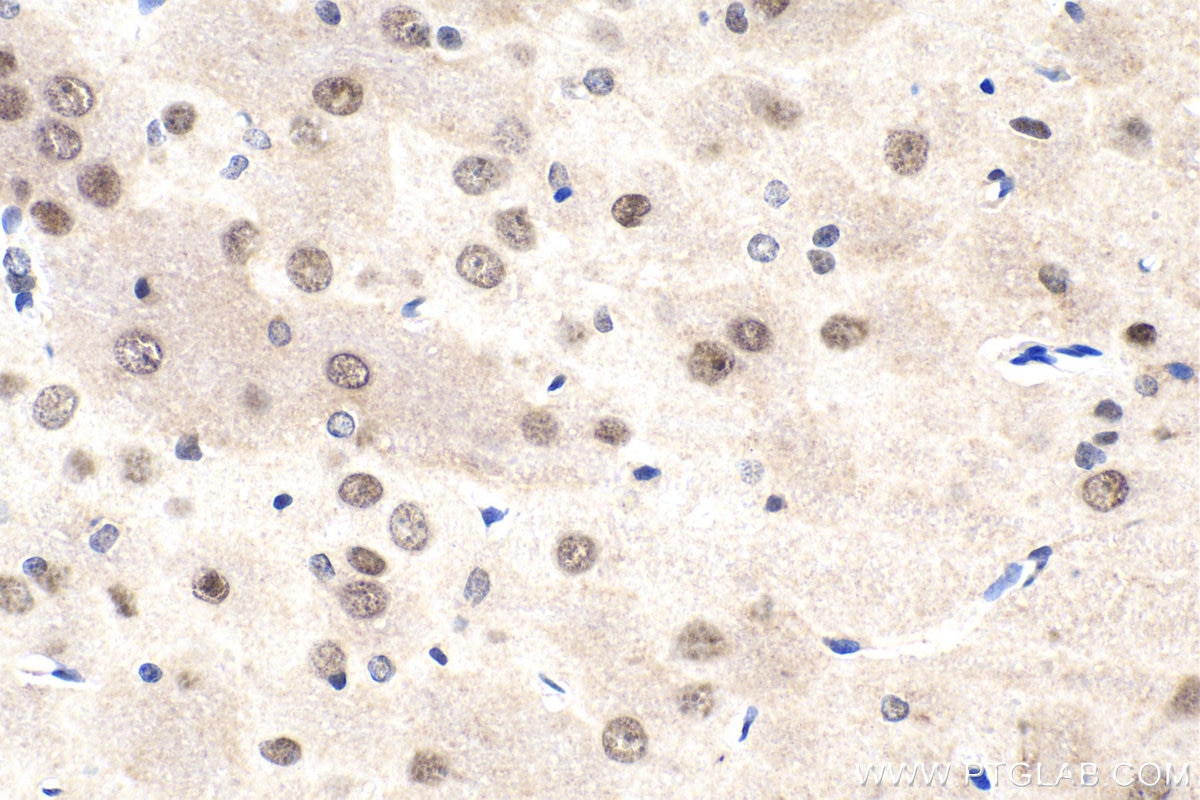 Immunohistochemical analysis of paraffin-embedded rat brain tissue slide using KHC1929 (HIPK2 IHC Kit).