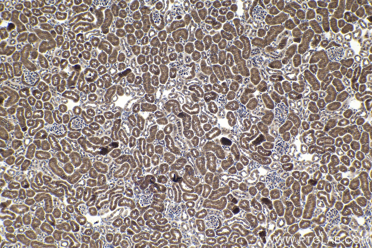 Immunohistochemical analysis of paraffin-embedded mouse kidney tissue slide using KHC1929 (HIPK2 IHC Kit).