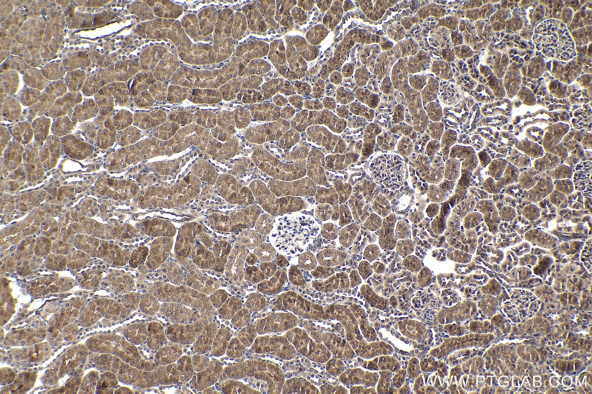 Immunohistochemical analysis of paraffin-embedded rat kidney tissue slide using KHC1929 (HIPK2 IHC Kit).