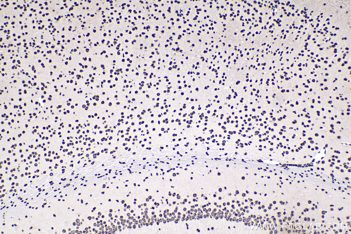 Immunohistochemical analysis of paraffin-embedded mouse brain tissue slide using KHC1675 (HIST1H3A IHC Kit).