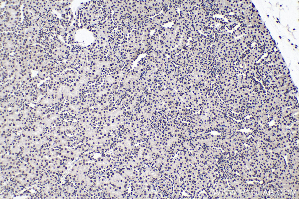 Immunohistochemical analysis of paraffin-embedded rat kidney tissue slide using KHC1675 (HIST1H3A IHC Kit).